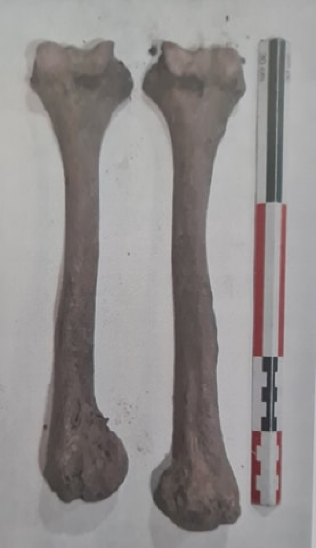 Плечевые кости мужчины. Заметно, что левая сломанная кость срослась и стала значительно короче правой. Фото из отчета об археологических исследованиях
