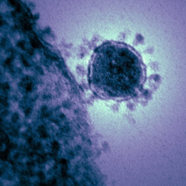 Момент прикрепления коронавируса к рецептору клетки 
