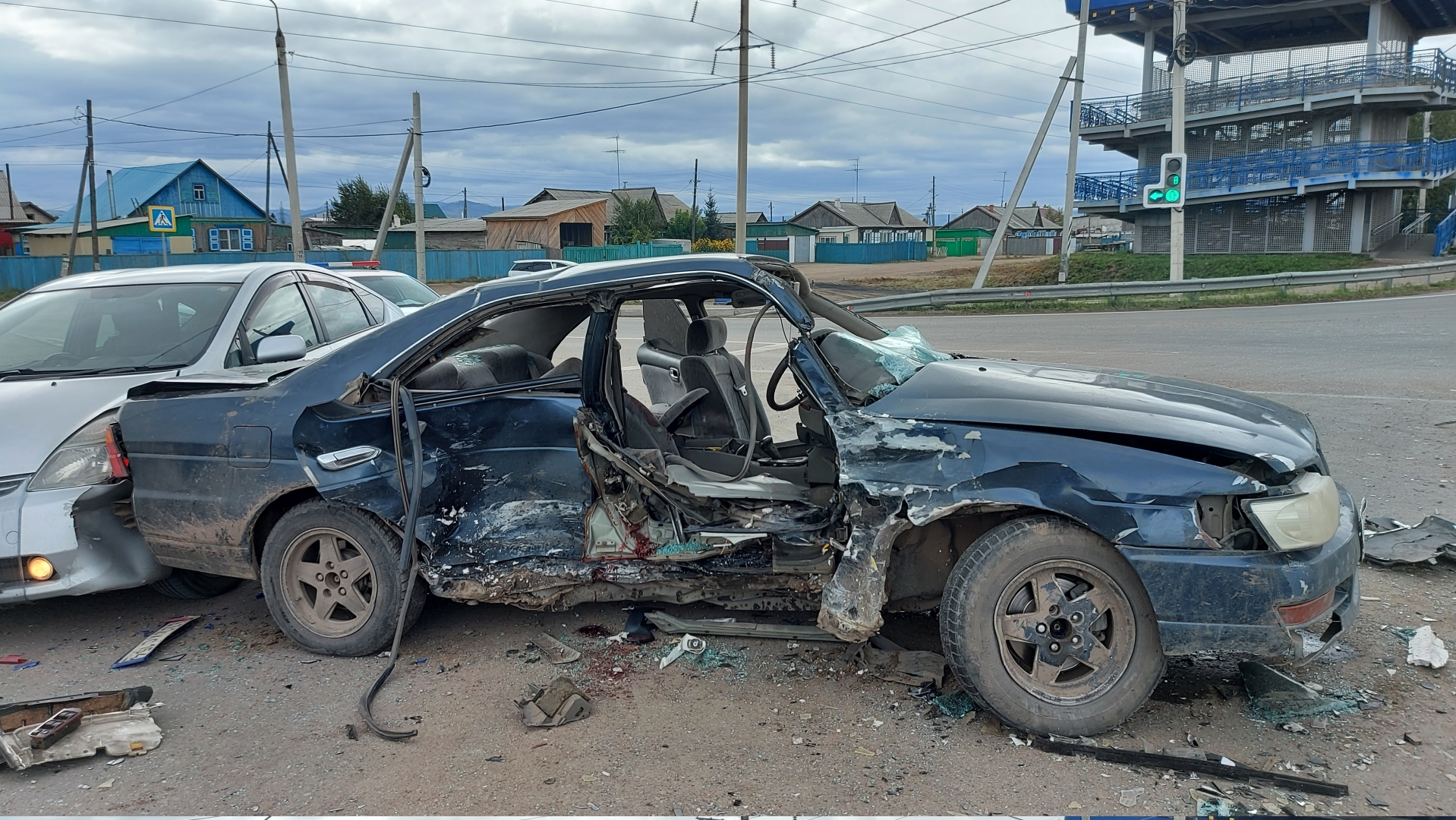 В больнице скончался пострадавший в тройном ДТП под Улан-Удэ